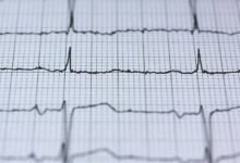 nova pulse strategic orbit designation